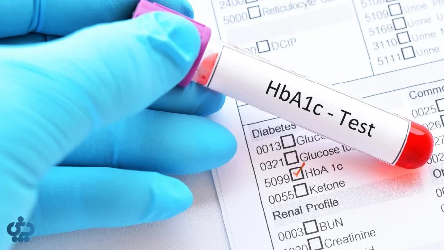 علائم اولیه دیابت که نباید نادیده بگیرید