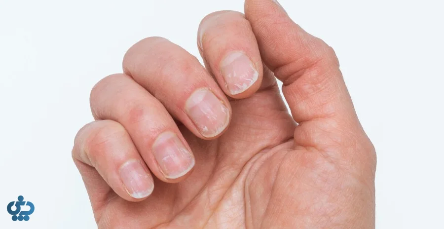 چطور ناخنهای سالم و محکم داشته باشیم