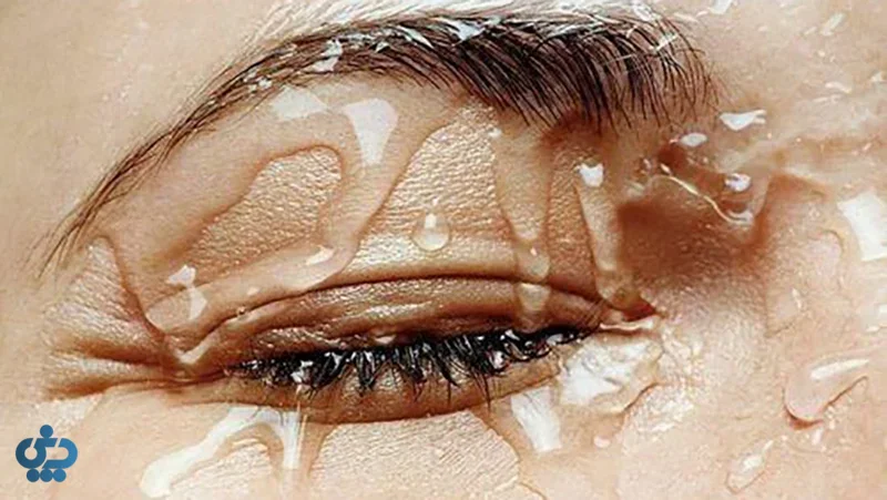 مراقبت و رسیدگی به مژه‌ها پس از انجام لیفت